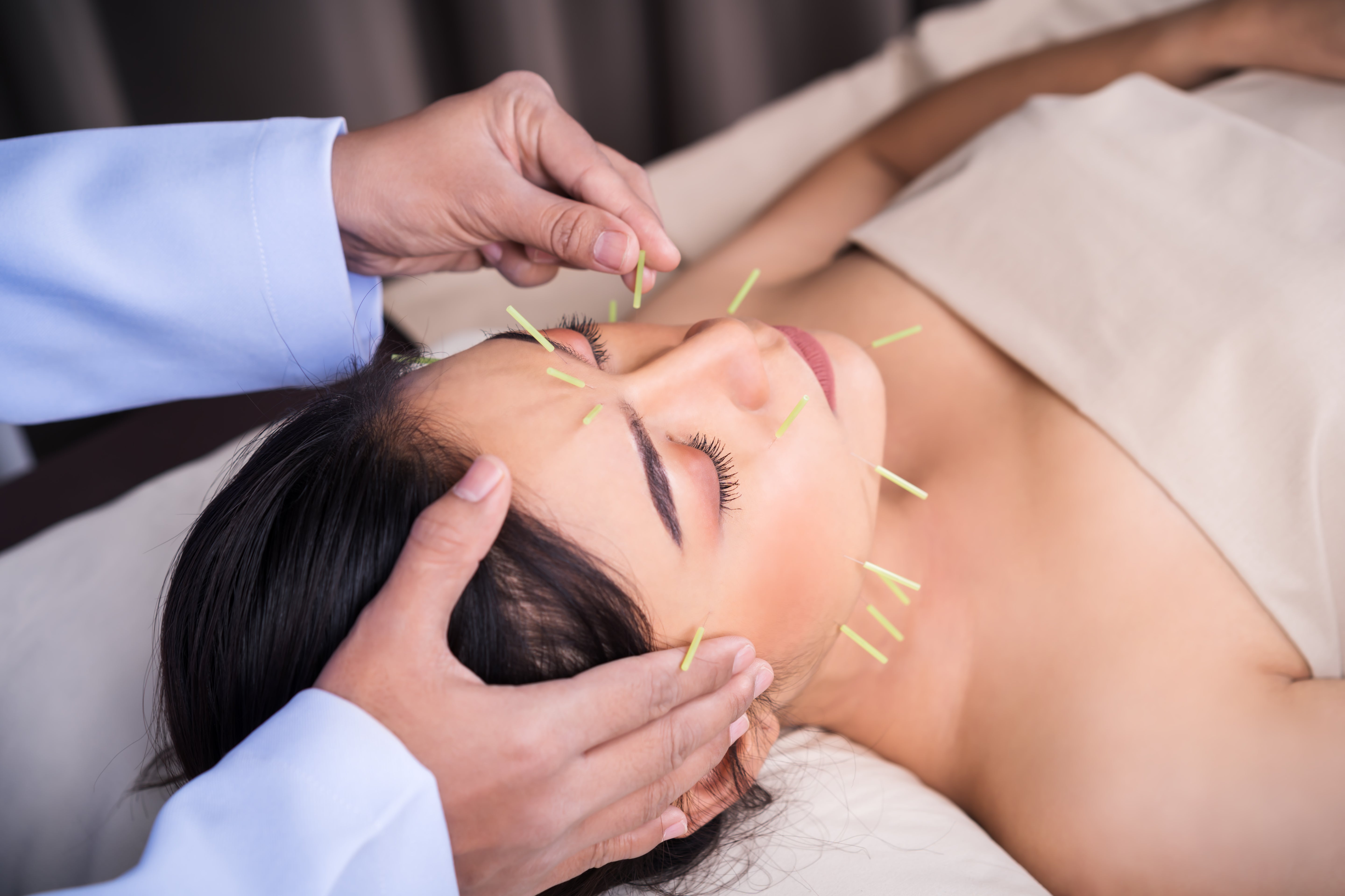 Acupuncture
